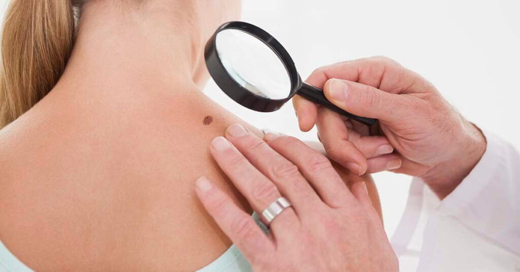 Consulta dermatológica em São Paulo: o que esperar